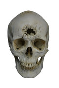 Blunt Force Trauma Forensic Skull Halloween decoration