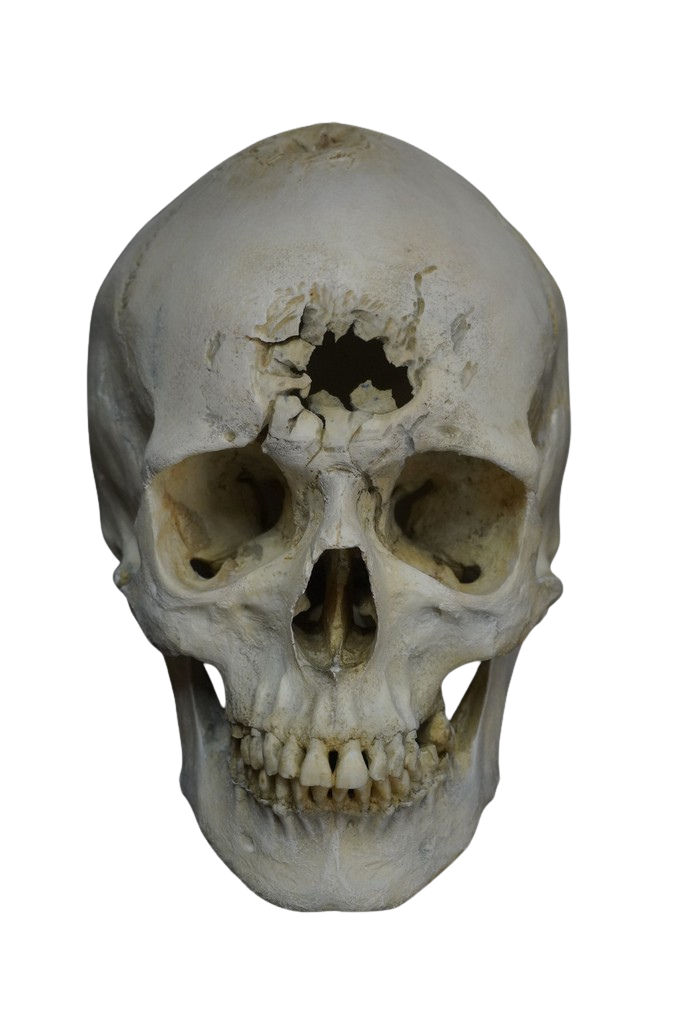 Blunt Force Trauma Forensic Skull Halloween decoration